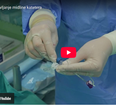 Mideline kateter – postavljanje i upotreba